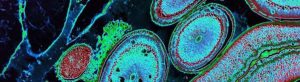 parasite treatments gauteng